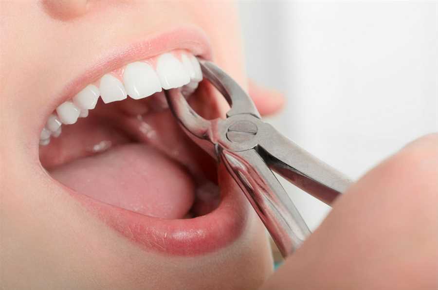 Antalya Tooth Extraction Antalya Dental hospital