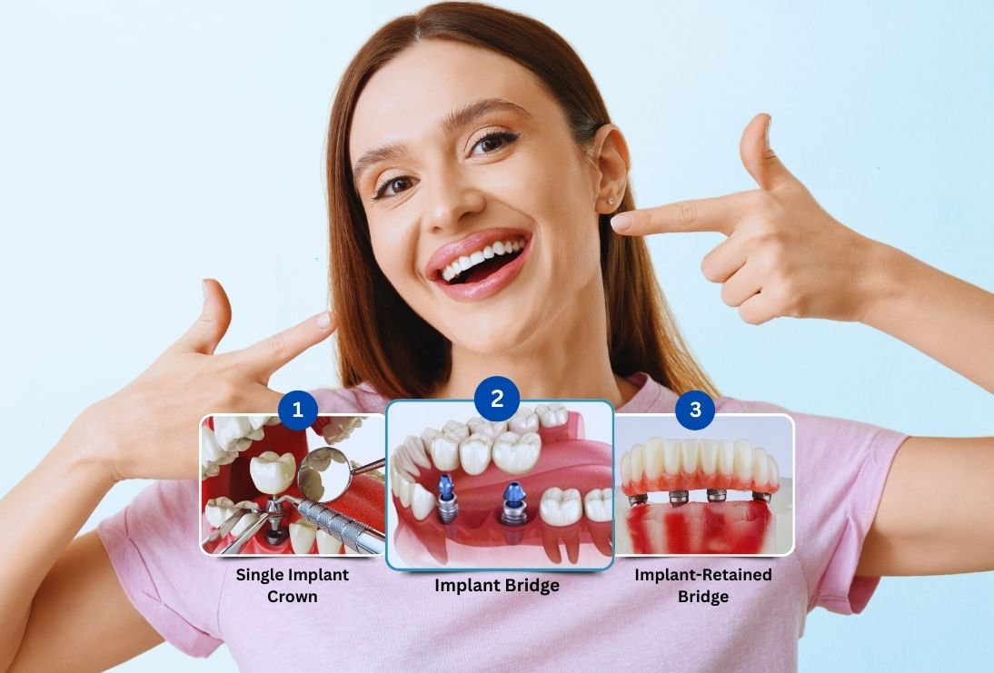 Antalya dental implants hospital dentist