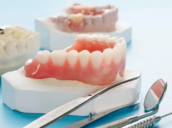 Aesthetic Dentures in Antalya Price, Types of Dentures