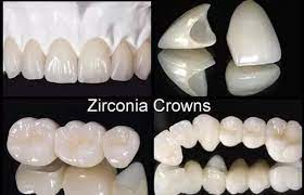 Zirconium-crowns-in-antalya turkey